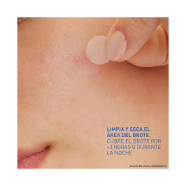 CERAVE ACNE PARCHES ANTIIMPERFECCIONES 22CT
